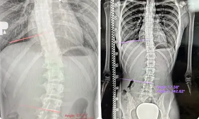 Centrum Chorób Kręgosłupa Łukasz Stoliński